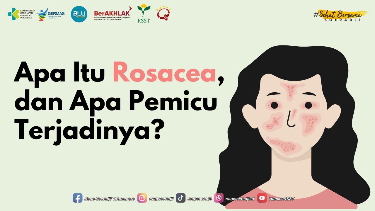 Apa Itu Rosacea? dan Penyebabnya