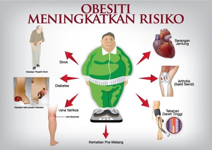 Bahaya Obesitas Meningkatkan Resiko Serangan Jantung